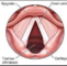 Wexham Airway Group